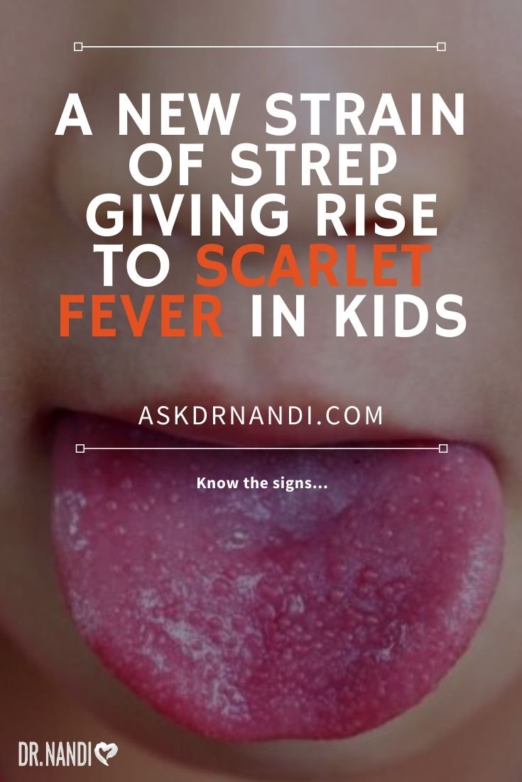 A New Strain of Strep Giving Rise To Scarlet Fever In Kids Ask Dr Nandi