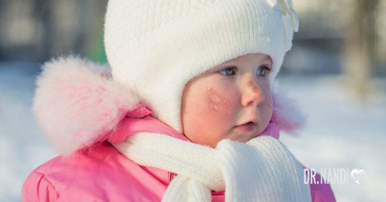7 Steps for Keeping Your Kids Safe in Winter