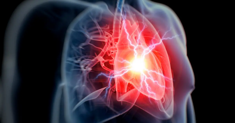 Is It a Heart Attack or Cardiac Arrest? Knowing the Answer Could Save a Life