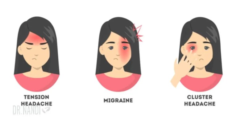 10 Types of Headaches and the Best Way to Get Rid of Them