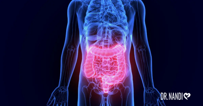 Ultimate Guide To Heal Irritable Bowel Syndrome (IBS)