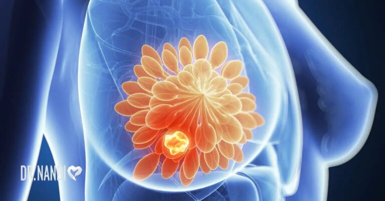 Breast Cancer: Causes, Symptoms, and Solutions