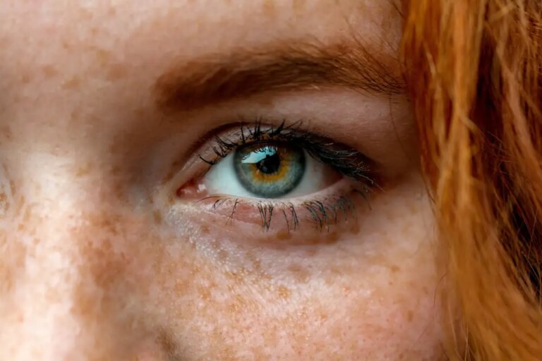 Scientists Crack Code on Why Red Heads Can Tolerate Higher Levels of Pain