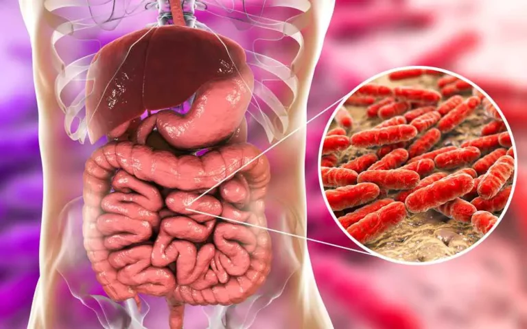 Shield Your Health: Avoid the Worst Foods for Gut Health and Combat Disease