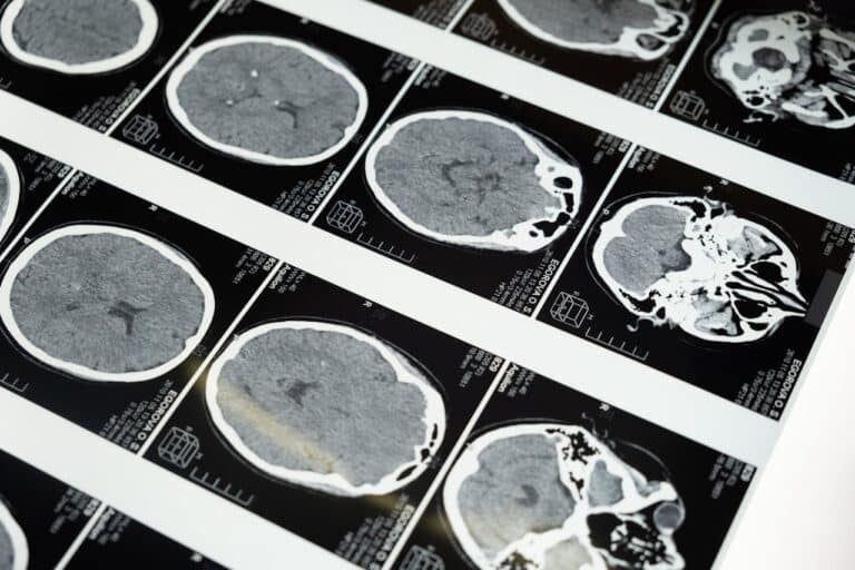 Can Your Brain Grow New Cells as You Age? Science Says Yes
