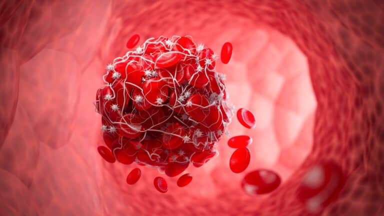 Long COVID and Sticky Microclots: The Hidden Blood Changes Behind Fatigue and Brain Fog