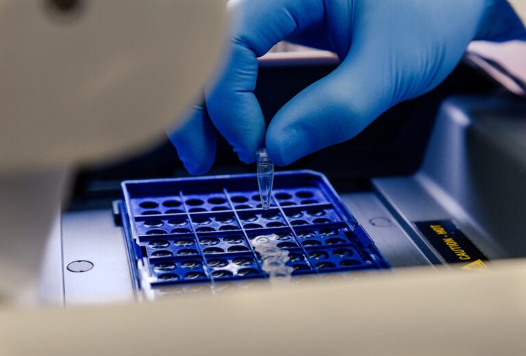 New Gene-Editing Treatment Lowered LDL Cholesterol by 52% With Just One Infusion